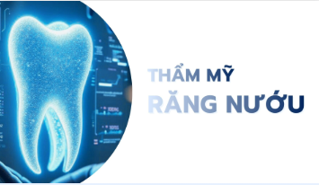 Thẩm mỹ răng nướu - Công Ty TNHH Dịch Vụ Nha Khoa Quốc Tế Smilux Dental